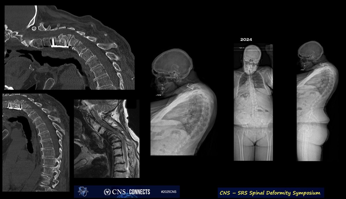 Michael Galgano MD tweet media