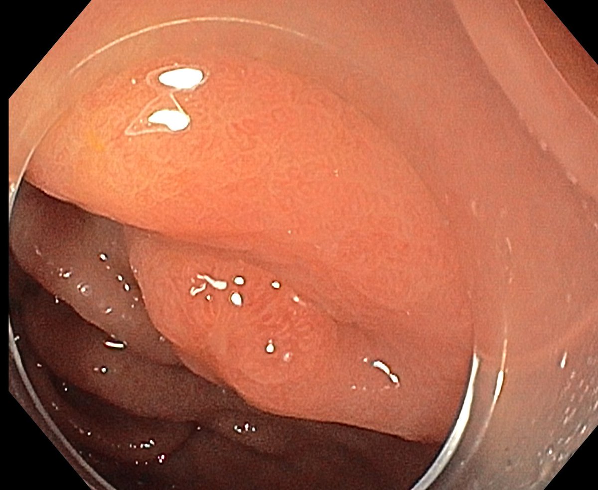 Aleksandar Gavric tweet media