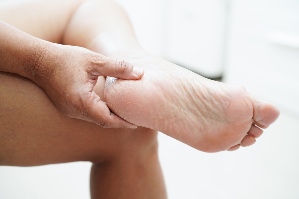 PatelPodiatry's tweet image. Mornings shouldn’t start with stabbing heel pain. We’ve got solutions to ease your first step. #PlantarFasciitis #HeelHelp
bit.ly/3QjcNvz