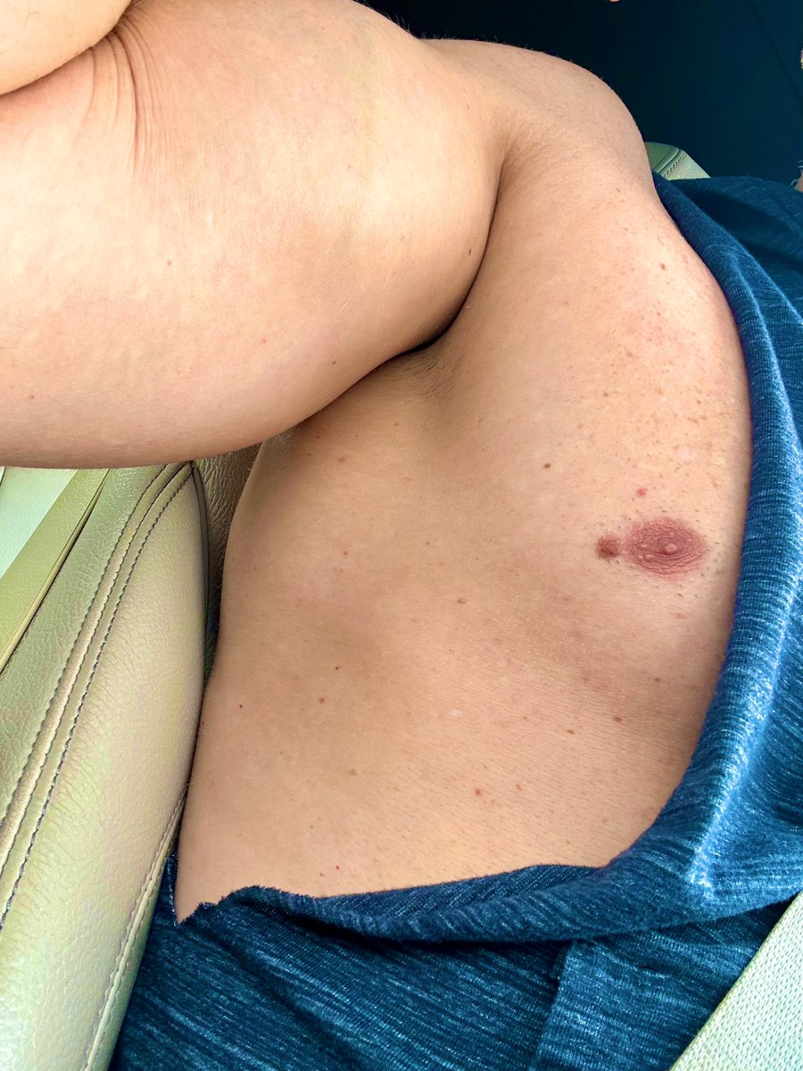 bulgesportboy's tweet photo. Progress check for biceptember. #progress #progresscheck #biceptember #bicep #stillalongwaytogo #gaygym #gay https://t.co/lW1sQxPzEZ