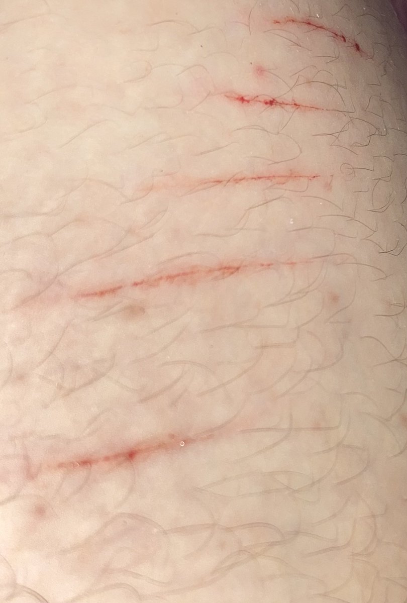 Xcry_____'s tweet photo. #SELFHARMTRIGGERWARNING #selfharms https://t.co/cRqP06CNRX