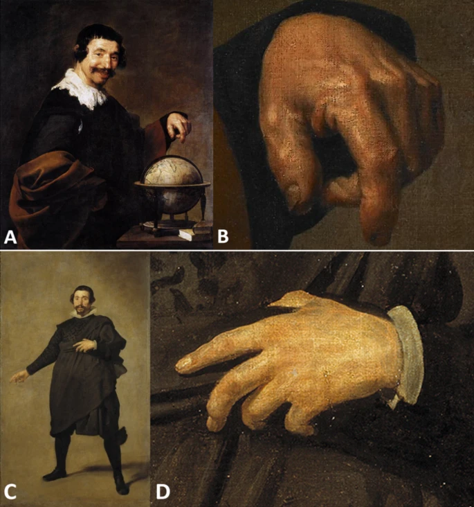 Rheumatology International tweet media