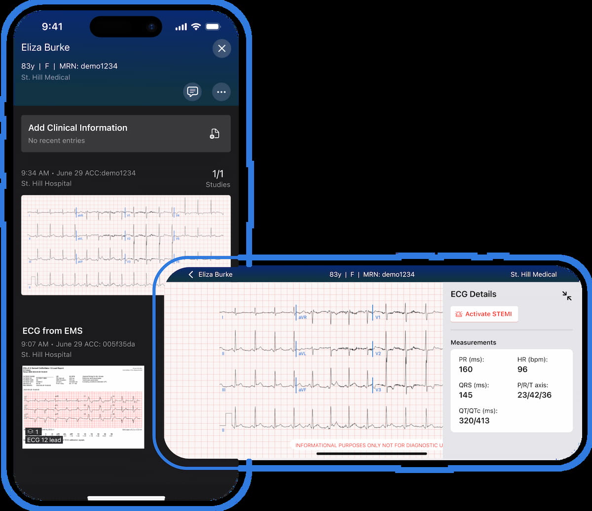 Viz ai Launches ECG Platform to Streamline Workflow for Patients with #AcuteCoronarySyndrome
diagnosticimaging.com/view/viz-ai-ec…
<a href="/RadiologyACR/">American College of Radiology</a> <a href="/ARRS_Radiology/">ARRS</a> <a href="/RSNA/">RSNA</a> <a href="/UofURadiology/">UofURadiology</a> <a href="/OHSURadiology/">OHSU Radiology</a> <a href="/UWRadiology/">UW Radiology</a> <a href="/ERadSociety/">American Society of Emergency Radiology | ASER</a> <a href="/viz_ai/">Viz.ai</a> 
#radiology #RadRes