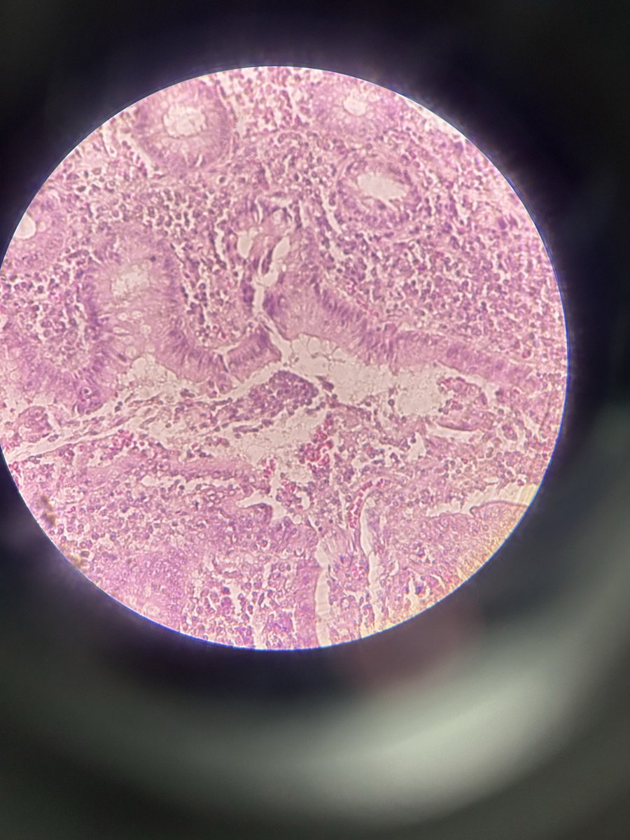 icey, kinda ia tweet media