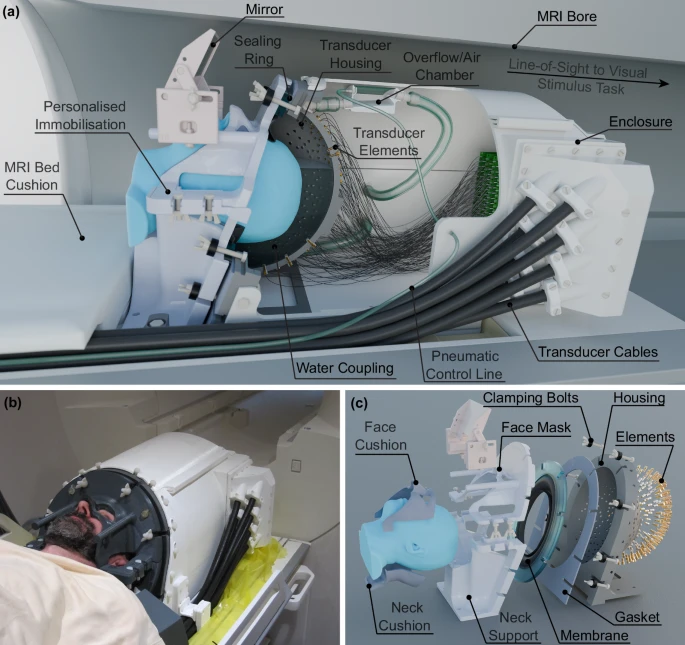 al_mashal's tweet photo. Inspiring to see work in the focused ultrasound space by other scientists and entrepreneurs! FUS in neuro applications is hot right now. Excited about the opportunity, will be interesting to see if the solution ends up geared for research hospitals (due to large equipment, need for MRI, etc.).

Looking at the heft of the image below, I’m even more impressed that our team @CurrentSurgical has been able to pack all of this technology into a super thin needle!