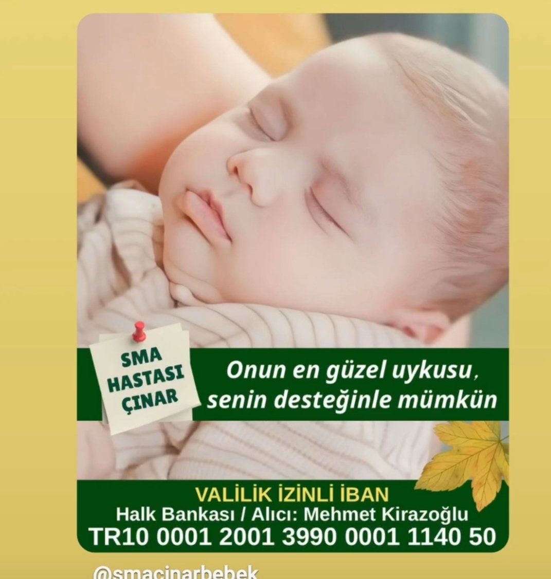 smacinarbebek's tweet image. 🔈paylaş 🔈paylaştır 🍀sizlerle güçlüyüz  #Zolgensma ilacina birlikte kavuşturalim 
🤲🏻Çınar için Şampiyonlarımızın 🇹🇷 imzaladığı  bu  forma  Açık artırmaya katılarak  sizin 
olabilir ‼️

ŞAMPİYON FENERBAHÇE 🏆 
#FBvVB #SarıMelekler #Vargas SözVerildiÜçYılGeçti
#BağkurNerede