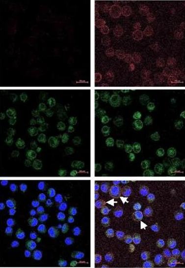 Intestinal_Cell's tweet image. 🔎 Scientists suggest that disrupting the dipeptidase 1–NKp30 interaction in colon cancer cells may enhance NK cell-mediated cytotoxicity.
go.nature.com/3Wf8aY5
