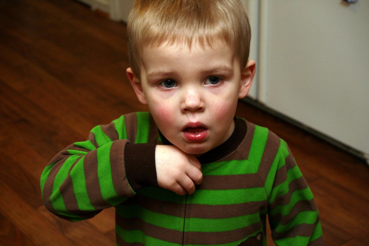 CIDRAP's tweet image. WHO #pertussis case definition misses many infections, needs revision, study suggests

Compared with WHO&apos;s definition, a modified definition including apnea but not cough duration boosted sensitivity but reduced specificity.

cidrap.umn.edu/pertussis/who-…

Photo: anjanettew / Flickr cc