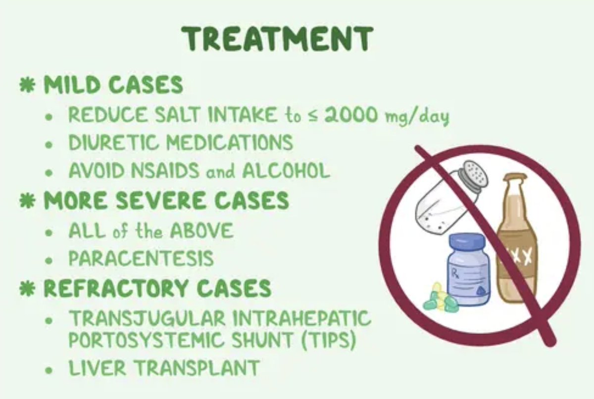 USMLEStepStudy's tweet image. Cirrhosis --&amp;gt; liver architectural distortion --&amp;gt; increased  intra-hepatic vascular resistance --&amp;gt; portal hypertension (elevated portal pressure) --&amp;gt; drives fluid from hepatic sinusoids thru surface capsule --&amp;gt; into peritoneal cavity --&amp;gt; overwhelming lymphatic drainage --&amp;gt; ascites