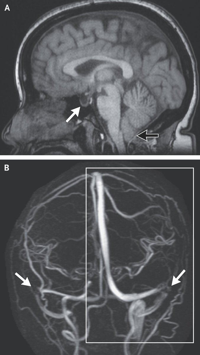 AshuJadhav tweet media