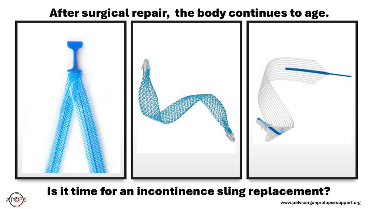 sherriepalm's tweet image. POP &amp;amp; sling surg in 2008. Now leaking when I sneeze. W/b exploring sling studies at AUGS industry booths next week. Industry shoot me your fresh studies by Monday so I can brush up in flight. How common? I feel an article coming on.

#womenshealthempowerment #APOPS #SUIsling
