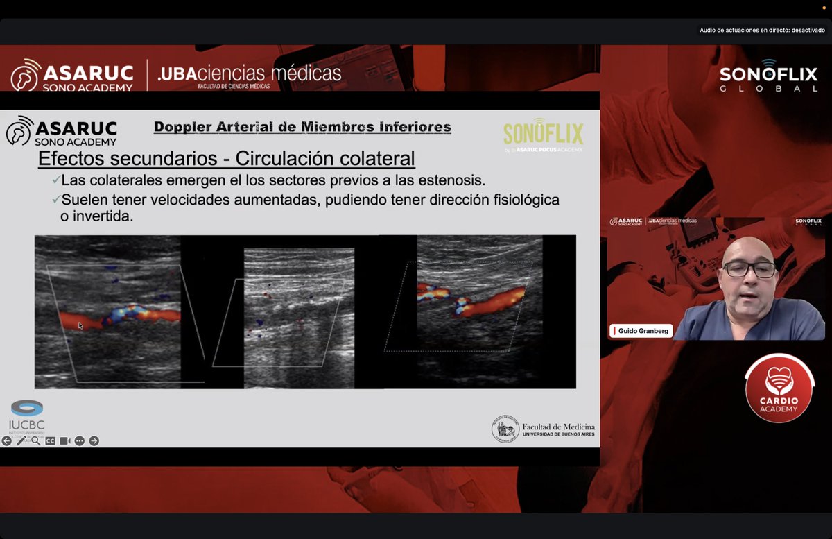 modulo de Doppler Vascular. Hoy: Dr Guido Granberg.
Diplomatura en Ecocardiografía ETT/ETE &amp; Doppler Vascular ASARUC/UBA 

Preinscripción 2026 disponible 👉 ASARUC.org