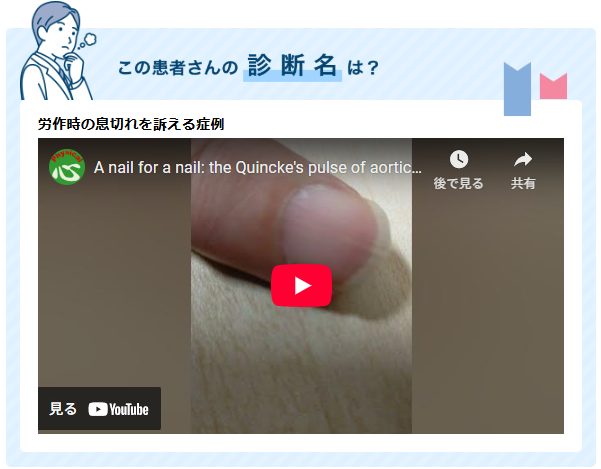 ＼CareNet 連載中／

お役立ちスキル🙂

diagnosticsimaging.carenet.com/backnumber.php…