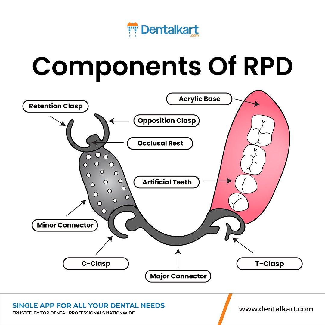 Dentalkart's tweet image. 𝐐𝐮𝐢𝐜𝐤 𝐆𝐮𝐢𝐝𝐞 𝐭𝐨 𝐑𝐏𝐃 𝐂𝐨𝐦𝐩𝐨𝐧𝐞𝐧𝐭𝐬! Every element of an RPD plays a vital role in restoring function, comfort, and aesthetics for partially edentulous patients.

Learn, Shop &amp;amp; Grow with Dentalkart, Your Trusted Dental Partner!
#DentalEducation #Prosthodontics