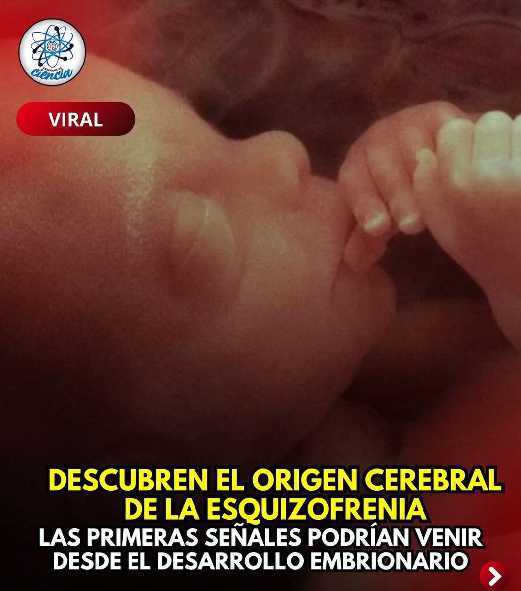 👨🏻‍⚕️⚕️El estudio, publicado en la revista Molecular Psychiatry, revela que los cambios en el hipocampo, que es una región crítica para la memoria, podrían iniciar durante el desarrollo embrionario. Lo que también podría indicar el origen de la esquizofrenia.🧠🤯

👨🏻‍⚕️🧠El cerebro