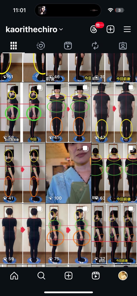 KAORItheChiro's tweet photo. https://t.co/x7iaLw3OW7 https://t.co/QgX9NR9qYs
