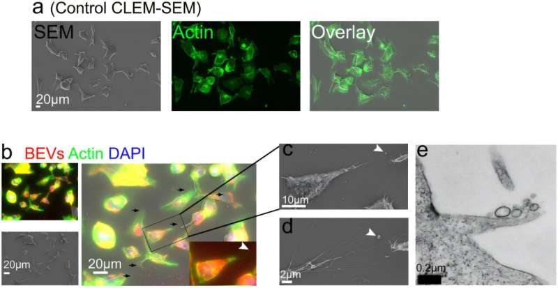 Idamr2026's tweet image. Bacterial 'bubbles' hitchhike to reach the cell surface, researchers discover: tinyurl.com/2tpsc8wp
For More Details Visit Our Website IDAMR 2026: infectiousdiseasesconclave.com
#microbiology #LifeUnderTheMicroscope #Microbiologist