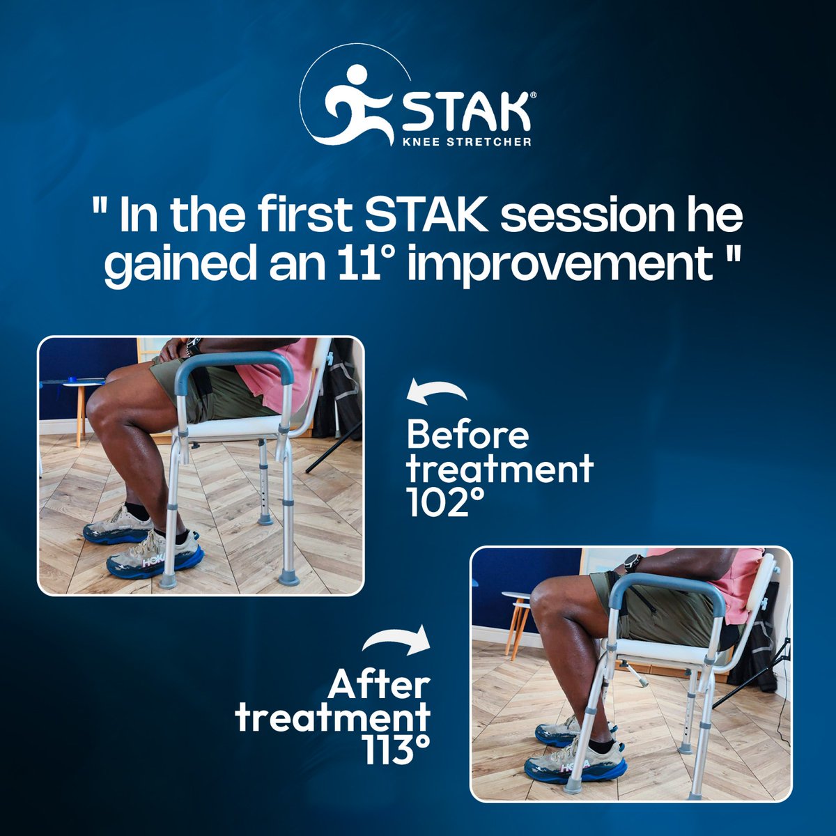 First STAK session and the client already gained 11° improvement. From 102° to 113° in one go. Real progress and real results 💪
👉 rfr.bz/tcb9062

#KneeRehab #Physiotherapy #STAKKneeStretcher