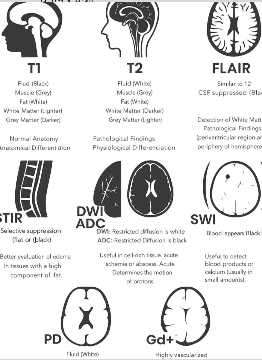 drsthanus's tweet image. A reference chart for different types of magnetic resonance imaging (MRI) sequences and their uses.
It explains the appearance of various tissues and pathological findings on T1, T2, FLAIR, STIR, DWI ADC, SWI, PD, and Gd+ scans.
instagram.com/p/DPico5Uk5O_