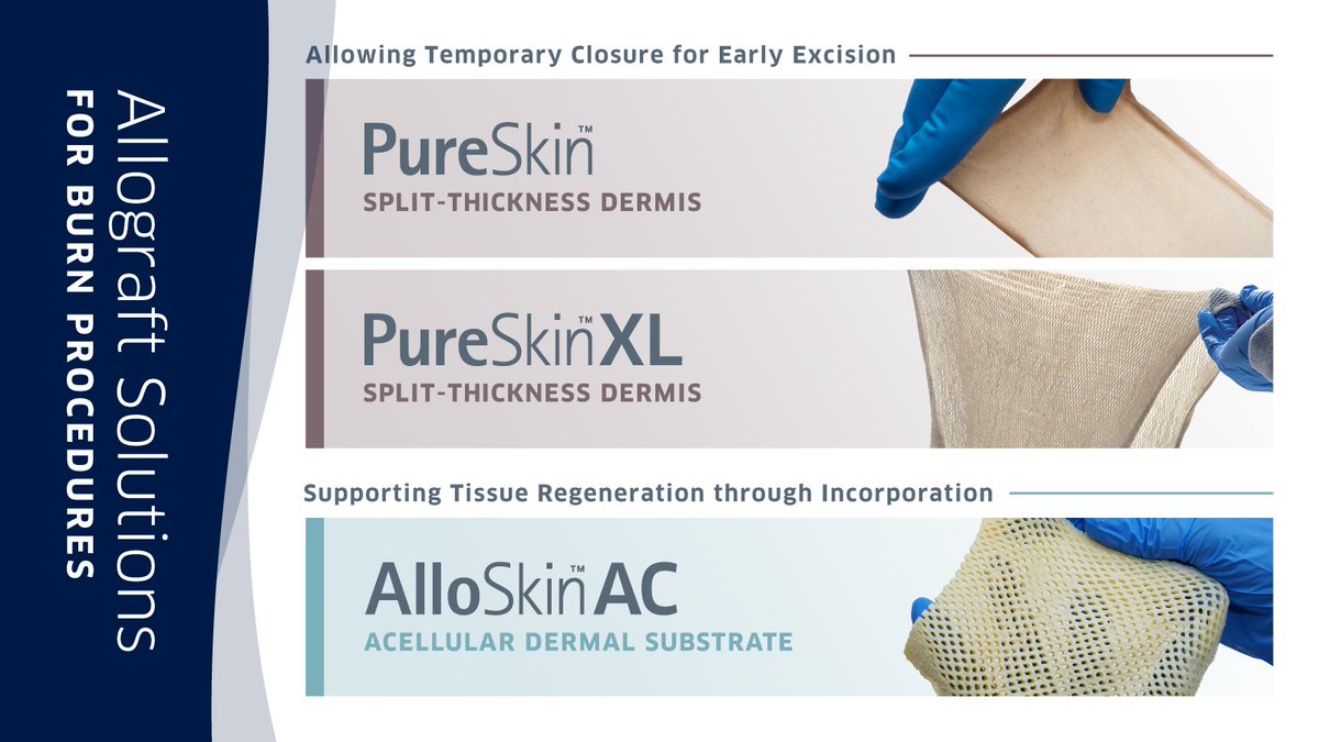 As a leading provider of allograft solutions for burn patients, we’re honored to help #burnsurvivors heal around the world. Join us next week at the Southern Region Burn Conference as we share our allograft portfolio and insights in #burncare. Learn more: brnw.ch/21wWSSk