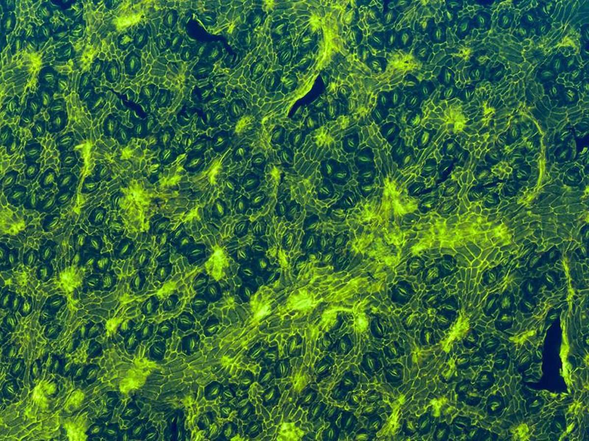 Terra_Rara's tweet image. Primeiro fóssil de Árvore tropical viva e ameaçada é descoberto
#Árvore

Pesquisadores encontraram, pela primeira vez, um fóssil de uma árvore tropical que ainda existe hoje, mas está em risco de extinção
Veja em:
terrarara.com.br/?page_id=26112