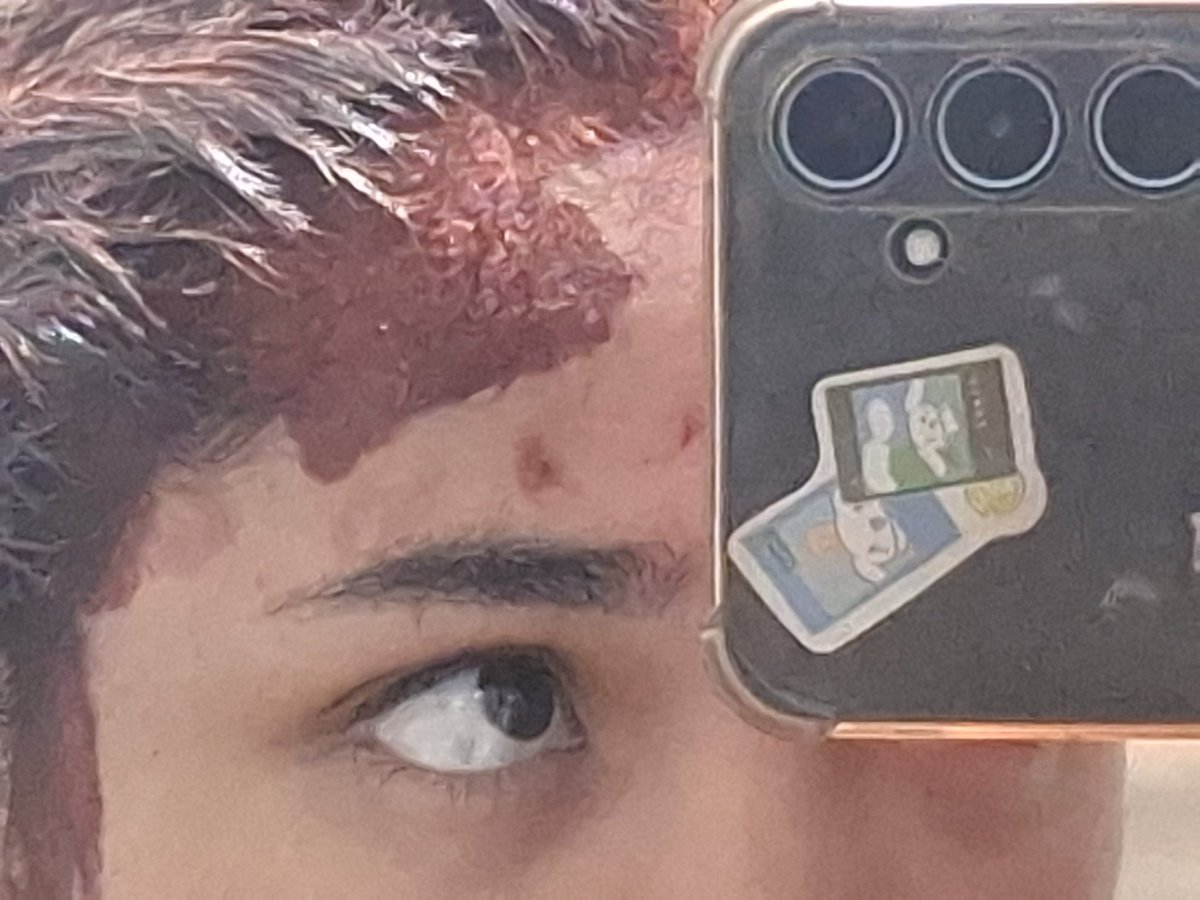 pov: vc foi atropelada e bateu a cabeça