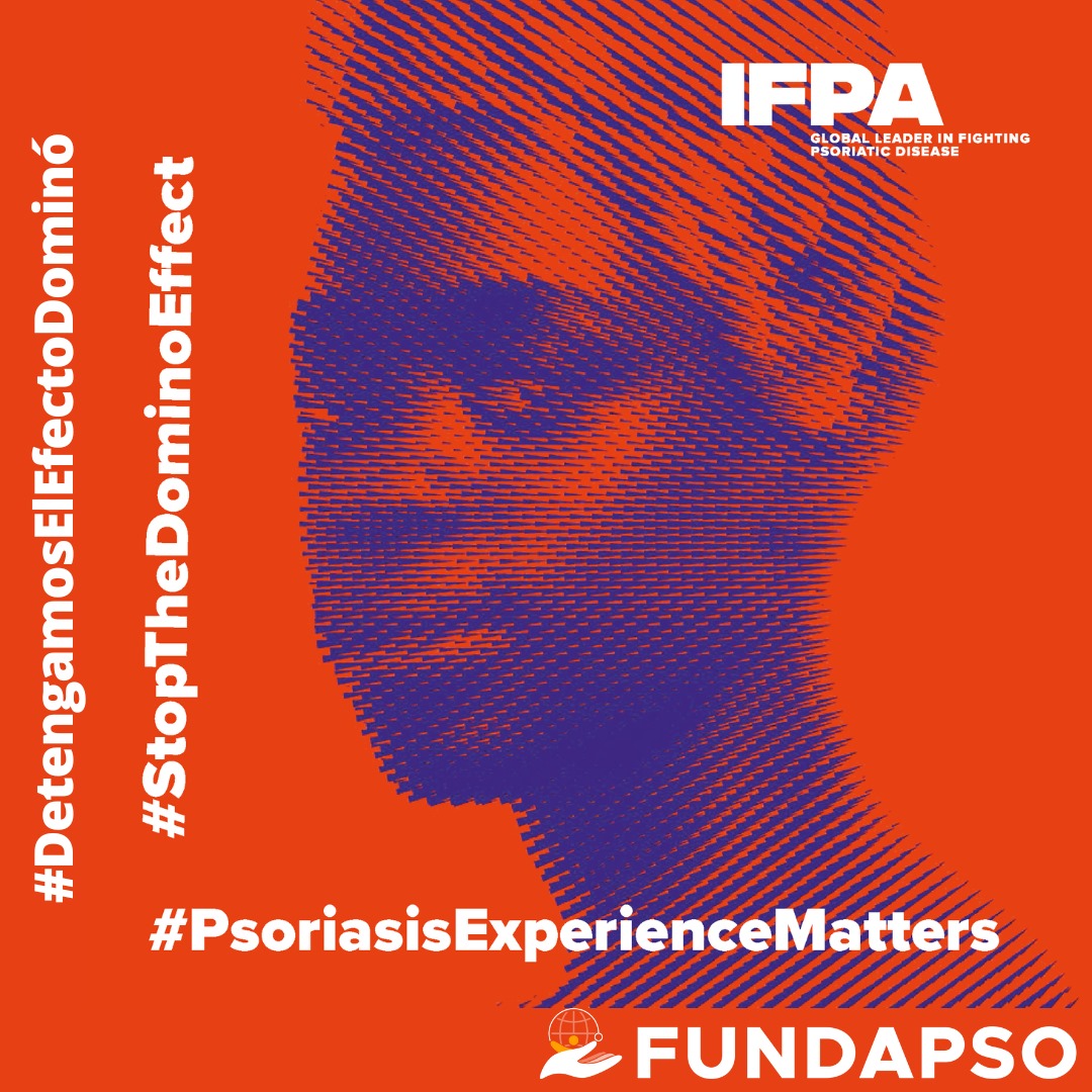 FUNDAPSO's tweet image. La Psoriasis no es solo una enfermedad de la piel. Su efecto dominó puede impactar todo el cuerpo y la mente. Únete a la campaña #StopTheDominoEffect #DetengamosElEfectoDominó en conmemoración del día mundial de la Psoriasis
#PsoriasisExperienceMatters #fundapso  #IFPA