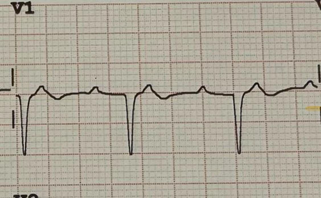 Fabricio Gaston Procopio tweet media