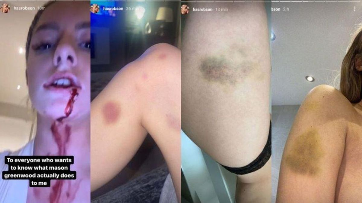 Capaz no juega en ningún club top porque la última vez que se cruzó con una mujer la dejo así. 

Digo, no sé.