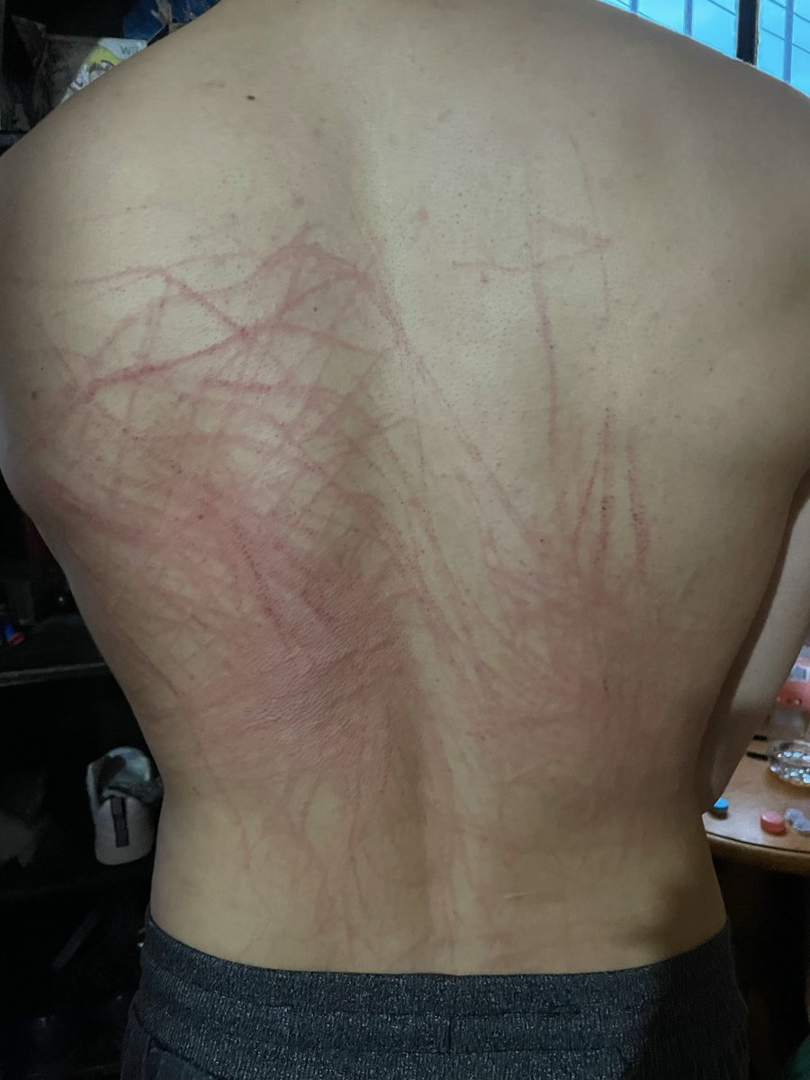 Pues con una vergota… como no le iba a dejar la espalda así 🍆🥵🔥