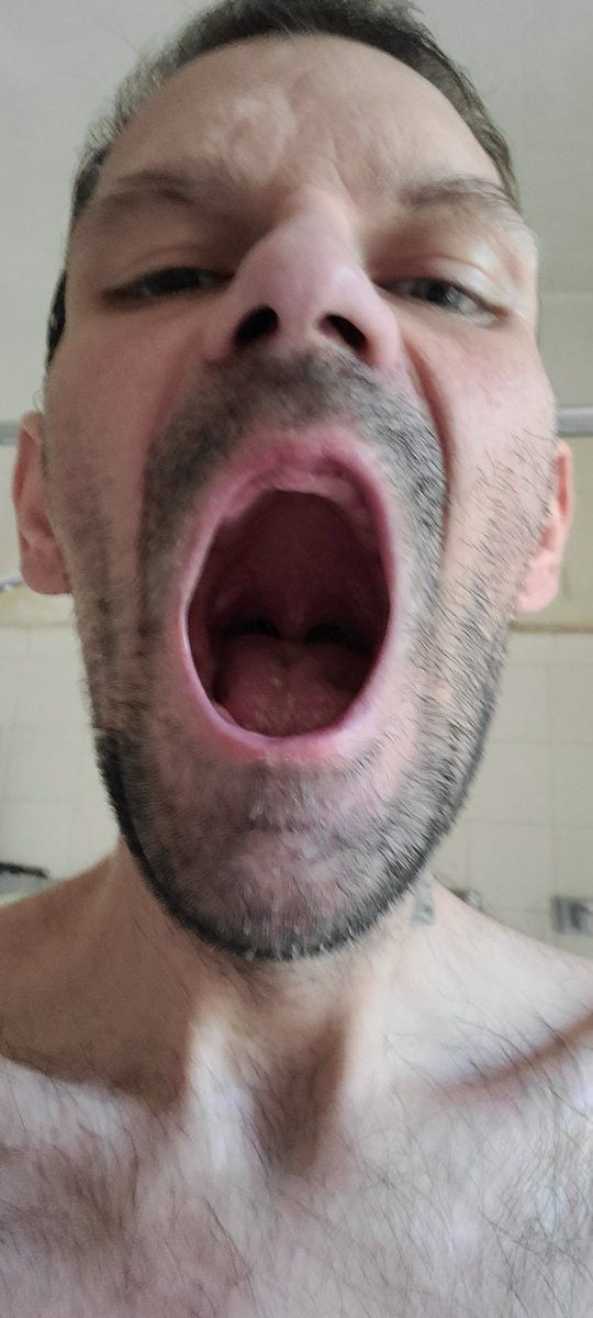 A lot has happened in the last 2 months. I lost a lot of weight, I got all my teeth pulled, I got and lost a job.
But bright side I'll be able to give some amazing head now.