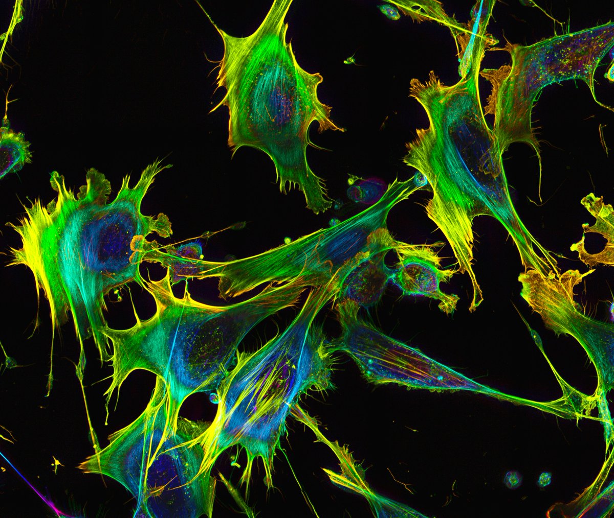 MAG2ART's tweet image. Cells and blebbisomes photographed through a microscope by Burnette Lab graduate student, Grace Ward. Actin filaments are shown. #CellBiology