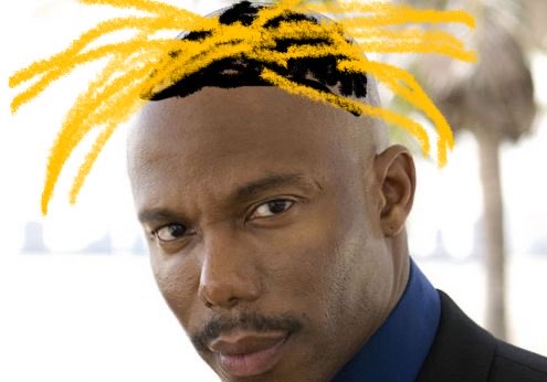 jviens de voir un mec avk une sale calvitie qui s’est fait des locks derrière la ou il reste des cheveux ça m’a fait penser a ça un peu