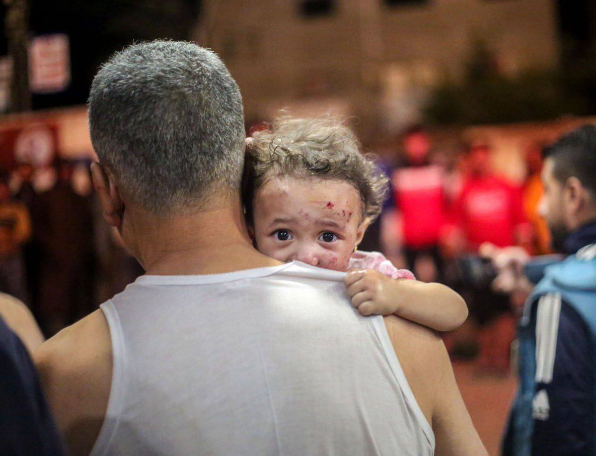 Marchfoward's tweet photo. KESIAN KANAK KANAK GAZA

Ribuan Kanak kanak Gaza kini dilaporkan mengalami kemurungan dan tidak lagi mahu bercakap kerana mereka mengalami trauma mental yang teruk disebabkan Genocide selama 2 tahun di Gaza 

Ini berdasarkan laporan Program Kesihatan Mental Komuniti Gaza GCMHP. Bahawa ribuan kanak kanak mengalami Traumatik Mutism di mana kanak-kanak boleh berkata kata tetapi bahasa dan perkataan mereka terperangkap dalam ketakutan, kejutan dan perasaan meratapi dan bersedih

Ada di antaranya menunjukkan simptom kronik seperti mimpi ngeri setiap kali tidur. Terlalu sensitif dgn bunyi bising, kencing dalam seluar setiap kali tidur dan tak mahu berkata apa apa walaupun tiada kecederaan fizikal pada suara vokal mereka. Perkara ini bukan sahaja berlaku pada kanak kanak muda tetapi turut kepada yang lebih berusia

Pihak Kementerian Kesihatan Gaza berusaha untuk memberi terapi psikologi kepada mereka namun diganggu dengan bekalan elektrik dan komunikasi terputus serta pengeboman berterusan 

Lebih separuh kanak kanak Gaza kini menghidap PTSS dengan pakar kesihatan mental menyatakan keruntuhan emosi dan bahasa mengancam untuk menyebabkan seluruh generasi Gaza menjadi bisu nanti