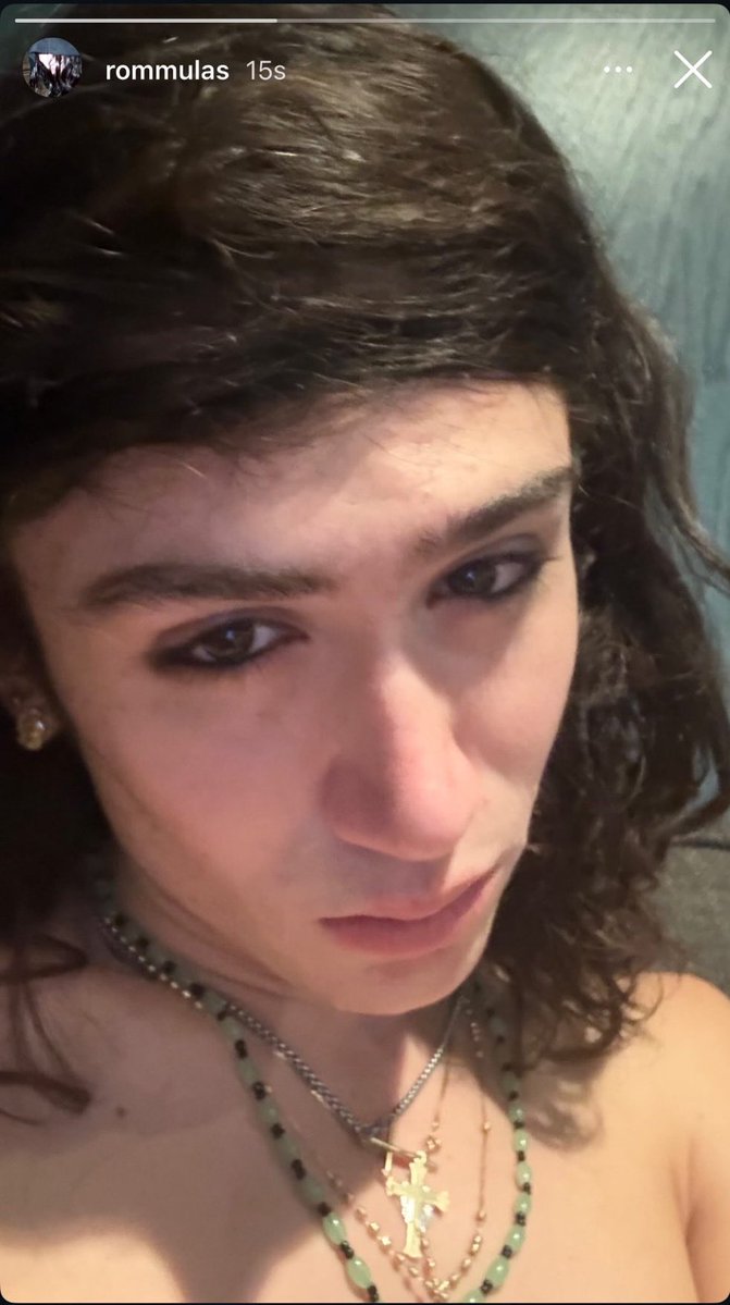 BoyliifeBase's tweet image. Rommulas shows off his side bang in recently deleted Instagram story!