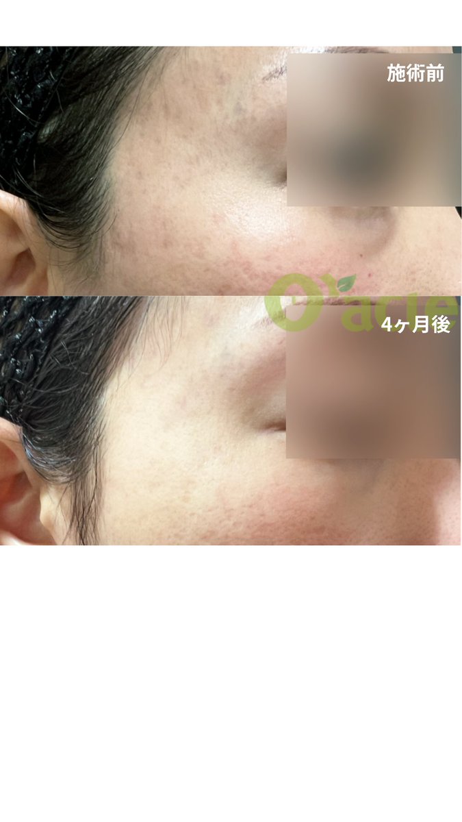 オラクル美容皮膚科【公式】 (@oracleclinic) / Posts / X