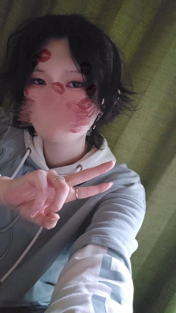 ホルモン注射5本目！！
この葉月、来月に睾丸摘出手術を受けることになりました🙏 
やっと自分の嫌なもののひとつを断ち切れる...！！
他にもめっちゃ楽しみにしてることがあるから来月が待ちきれない😊