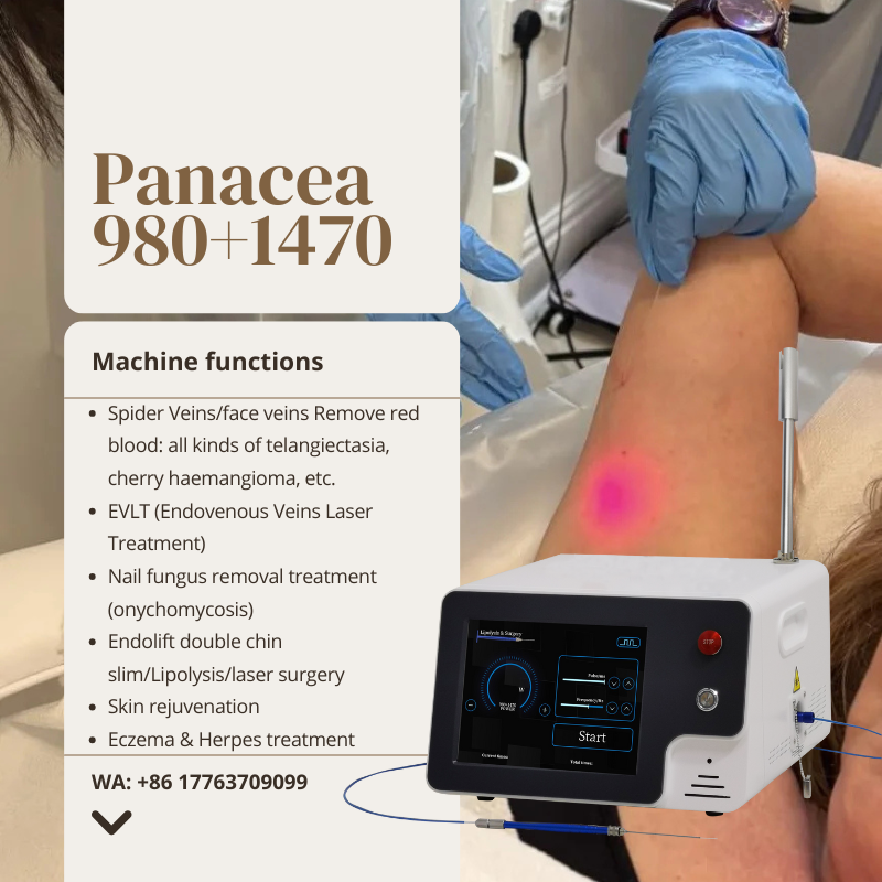 NGomecy9639's tweet image. Dual wavelength. Double results. ⚡
 980+1470nm Diode Laser for:
✅ Spider vein removal
✅ EVLT &amp;amp; vascular care
✅ Nail fungus &amp;amp; skin rejuvenation
✅ Double chin reduction
📧 natasha@gomecy.com | 🌐 gomecy.com
#DiodeLaser #VascularRemoval #Gomecy