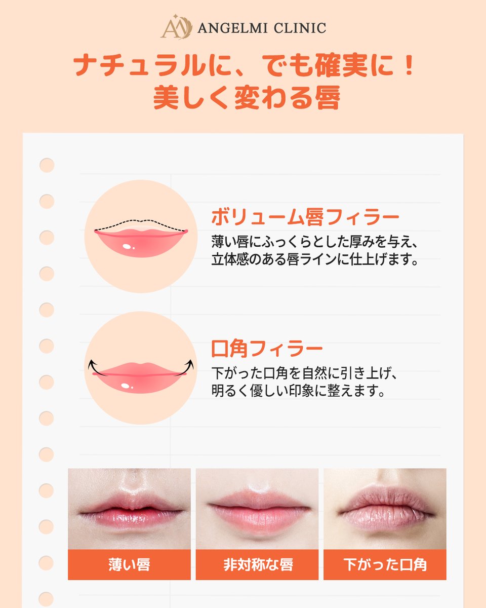 angelmiclinic's tweet image. ✨ボリュームリップ✨
笑顔がもっと愛らしくなる瞬間、
唇全体フィラー 👄
▶️ 97,900ウォン（税込）

#ふっくら唇 
#ボリュームリップ 
#口角アップ

エンジェルミ医院では、
豊富な経験と繊細な技術をもとに、
お顔のバランスに合わせたパーソナルデザインをご提案。 🧑🏻‍⚕️👩🏻‍⚕️…