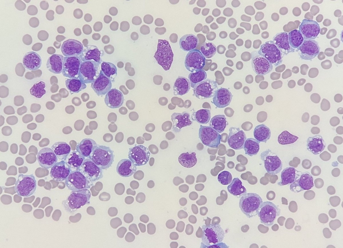 #hemepath
#onlycells