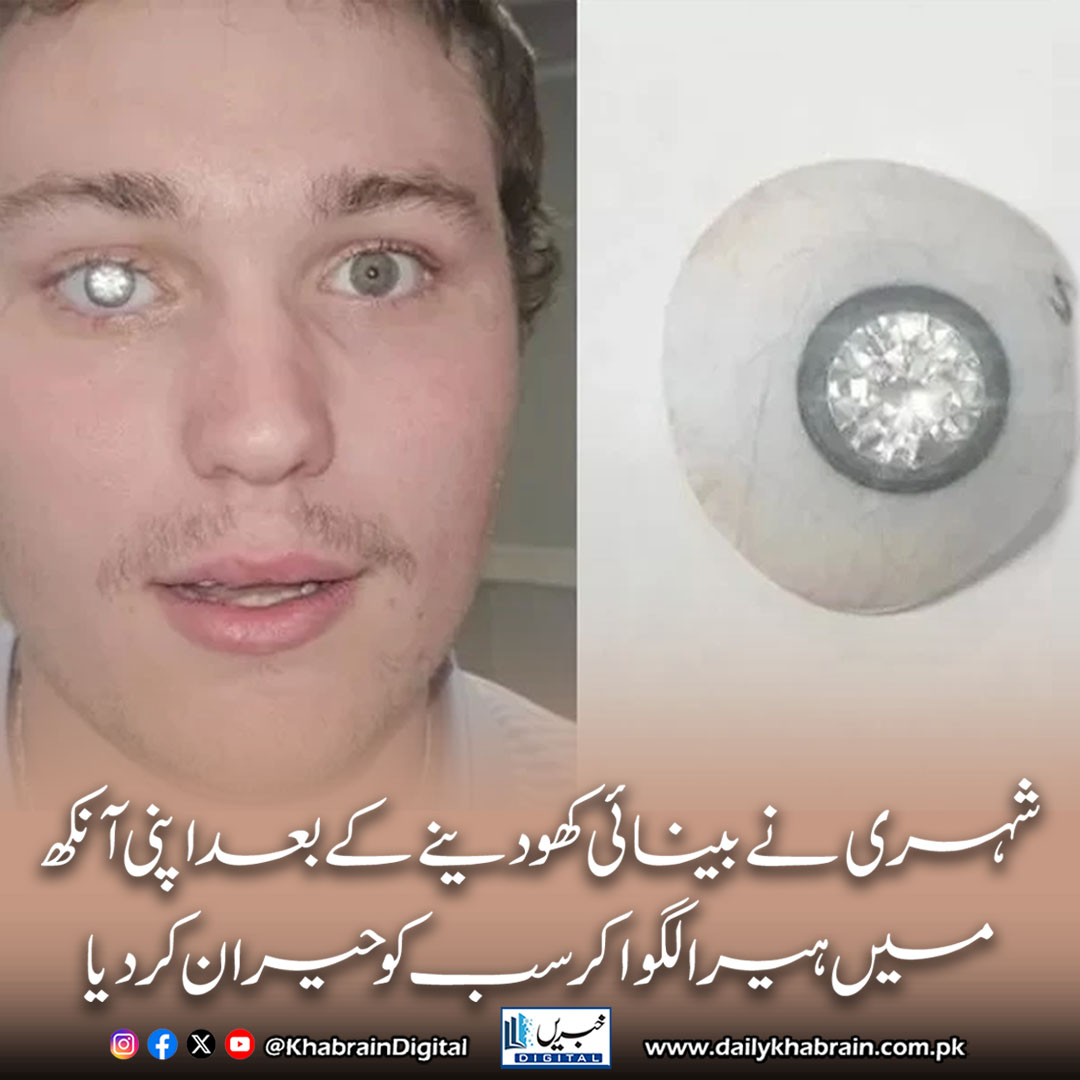 daily_khabrain's tweet image. شہری نے بینائی کھودینے کے بعد اپنی آنکھ میں ہیرا لگوا کر سب کو حیران کردیا
dailykhabrain.com.pk/2025/10/22/480…
Tap on the link to read full story 👆
#khabraindigital 
#ViralNews #Unbelievable #ManWithDiamondEye #ShockingStory #Innovation #TrendingNow #UniqueStory #WorldNews
