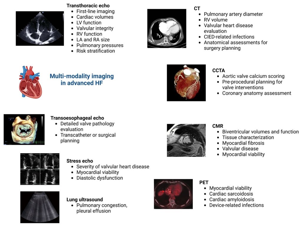 Multimodality imaging in advanced heart failure. A clinical consensus statement of the Heart Failure Association of the ESC. Part 1: Multimodality imaging for the evaluation of patients with advanced heart failure

The integration of these advanced imaging modalities enhances