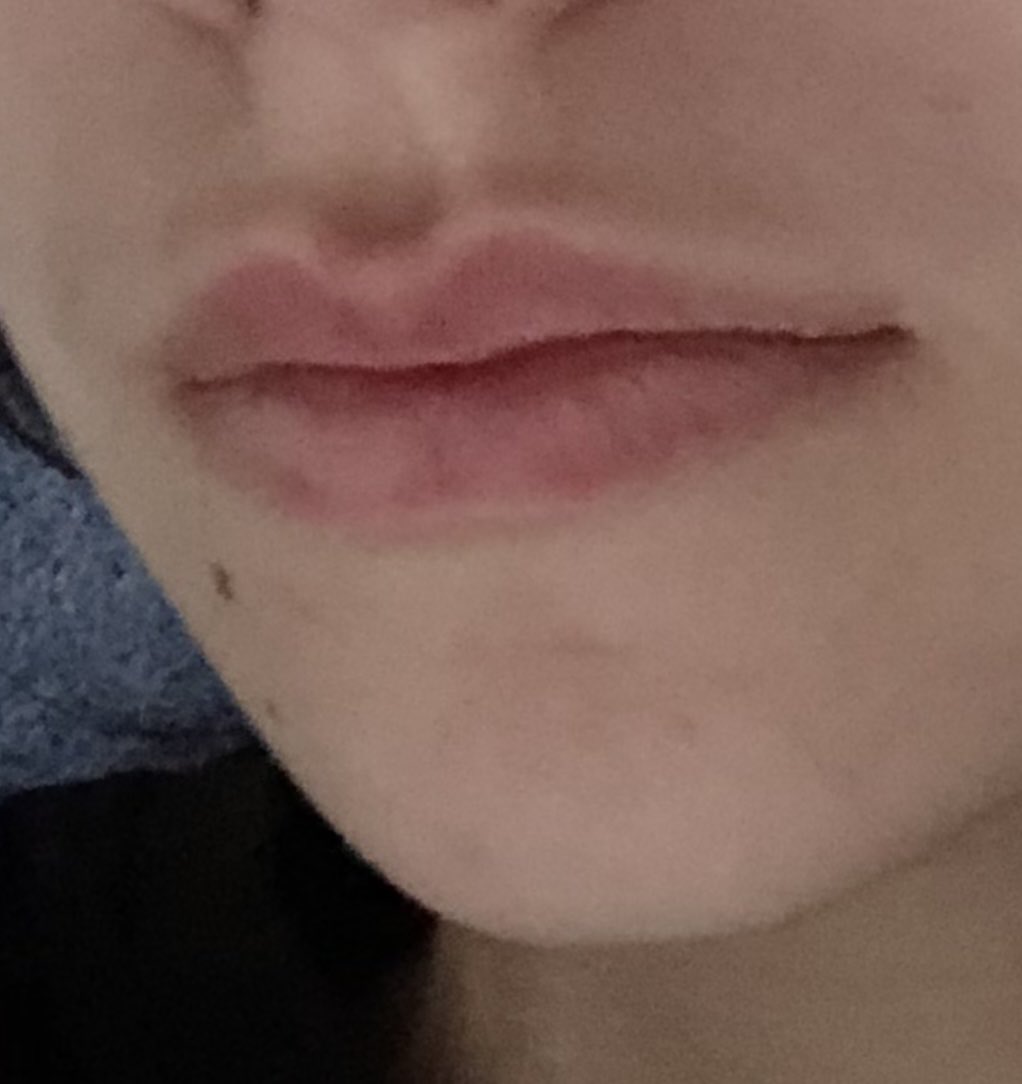 v4in_ak1's tweet image. anyone else feel lik their lips got bigger after losing weight 
2024 vs now