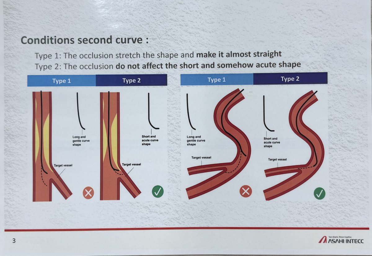 #wirology is one of my passions. 
Wire shaping is an art 🖼️ with no right or wrongs. 
These are some pictures from <a href="/AIU_Medical/">Asahi Intecc USA, Inc. Medical Sales</a> with a few tips for shaping wires. Important to find your own way respecting wire characteristics and being gentle not to destroy wire tip. Some wires