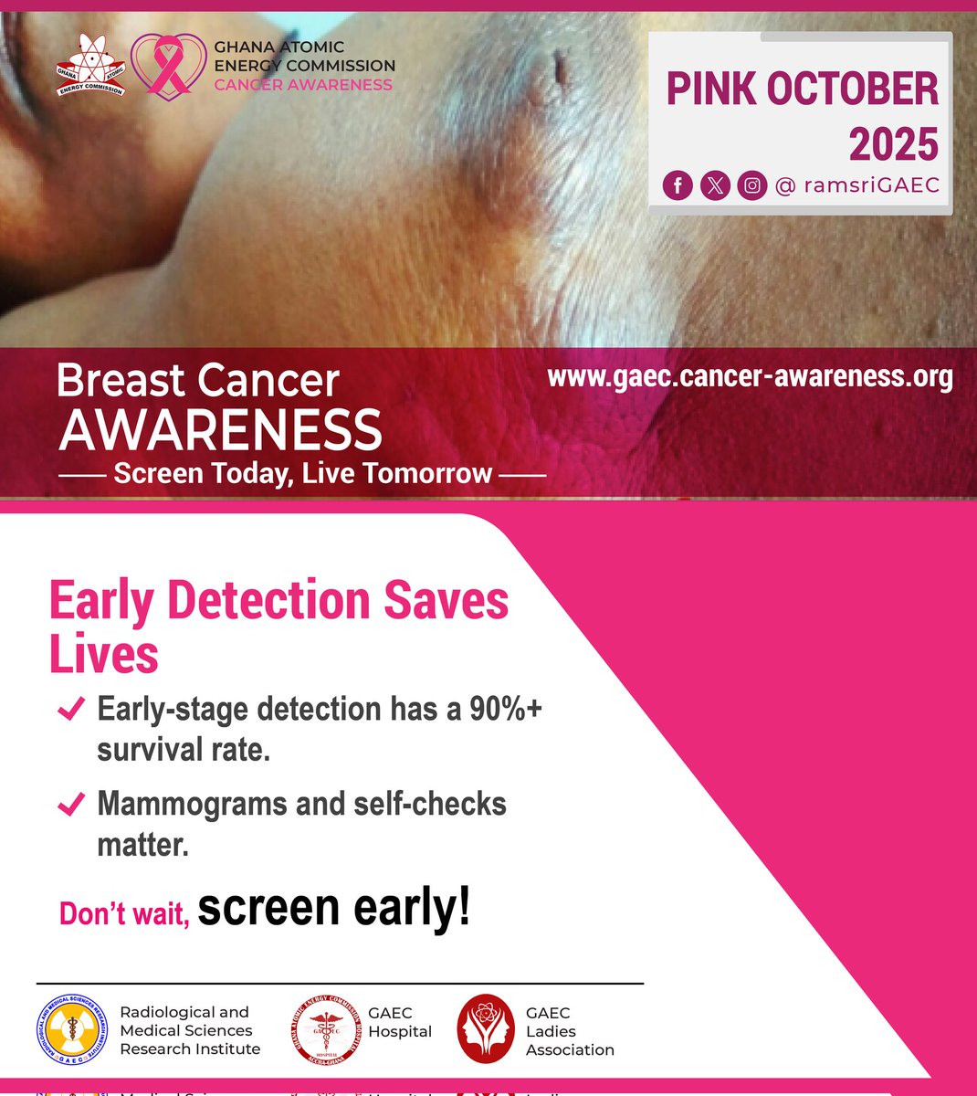 𝐏𝐢𝐧𝐤 𝐎𝐜𝐭𝐨𝐛𝐞𝐫  - 𝐁𝐫𝐞𝐚𝐬𝐭 𝐂𝐚𝐧𝐜𝐞𝐫 𝐀𝐰𝐚𝐫𝐞𝐧𝐞𝐬𝐬 𝐌𝐨𝐧𝐭𝐡 - DAY 22🎗 
Know the signs. Check yourself. Spread awareness
#BreastCancerAwareness #EarlyDetection #thinkpink