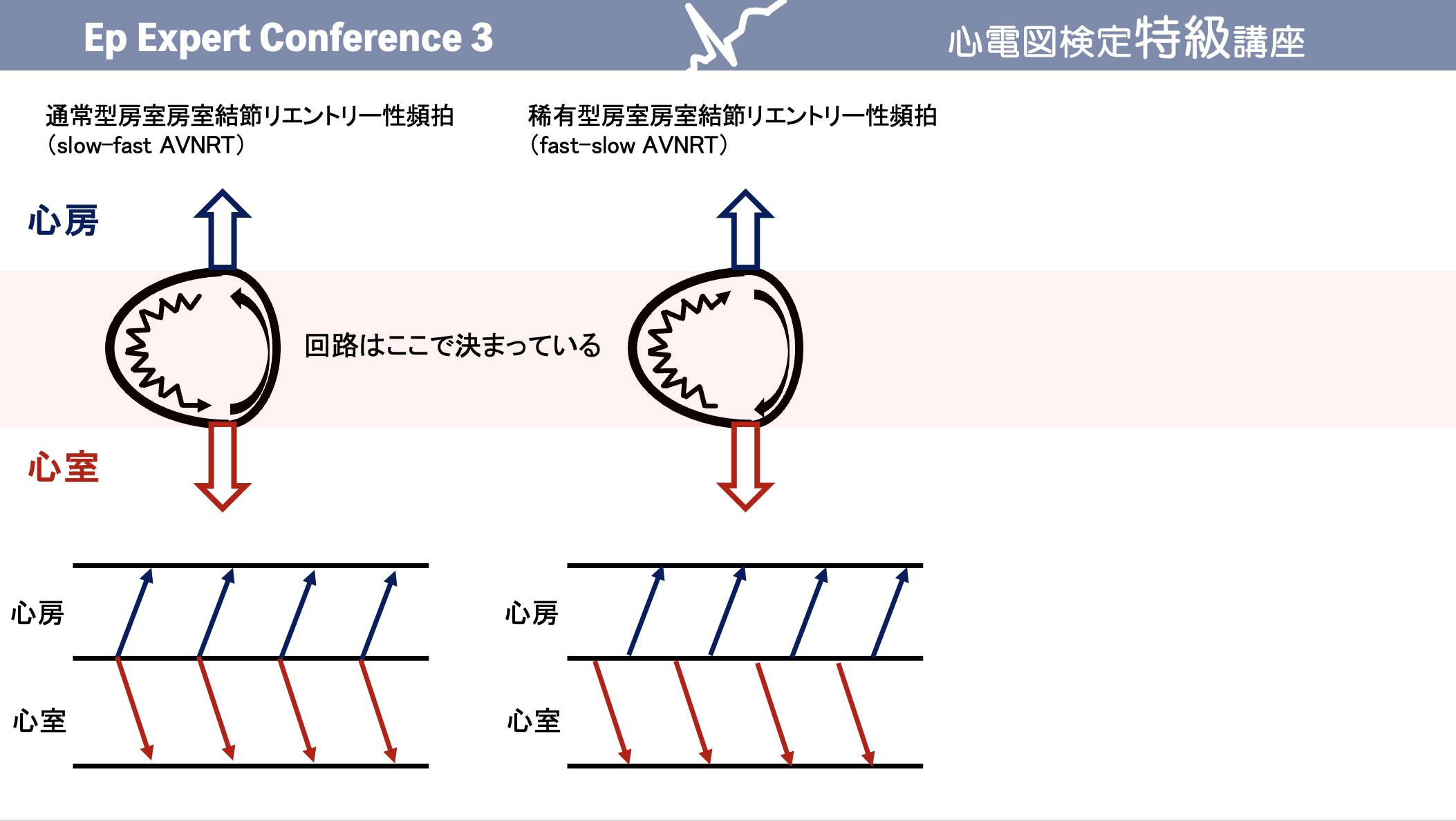 タイムセール！ER心電図の超速診断 カラー ER心電図の超速診断 救急現場で初心者から役立つ - 西村書店