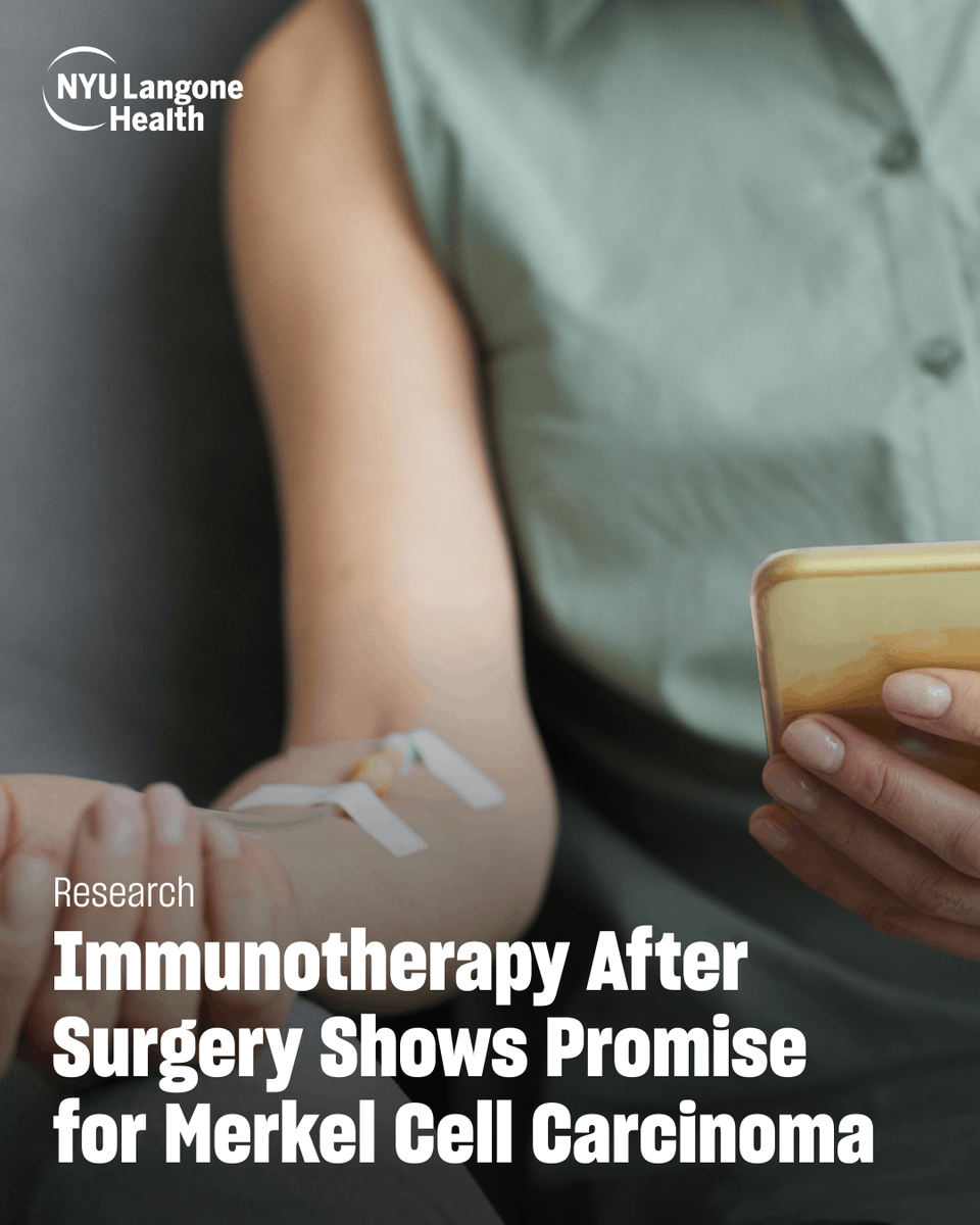 nyugrossman's tweet image. A study led by @nyugrossman  & @Perlmutter_CC suggests that immunotherapy with pembrolizumab after surgery may help reduce recurrence and improve survival for people with Merkel cell carcinoma. 
Read more: bit.ly/3WhsTKE