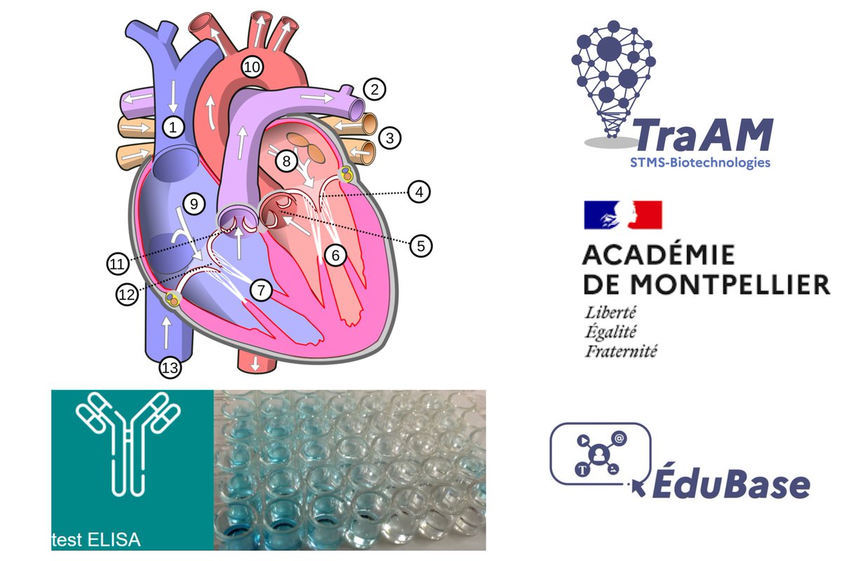 biotech_edu_num's tweet photo. [🔴 #TraAM Biotechnologies STMS 2024-25 ] : #Édubase - Aide à l'apprentissage de notions en #BPH grâce à l'Intelligence Artificielle ➡ Hémodynamique Cardiaque🫀 &amp; TP #ELISA 🧪. #ST2S
@acmontpellier  @DraneOccitanie @eduscol_SVT 
➡ https://t.co/iliSCM13Xt https://t.co/mqqm6Ystbo