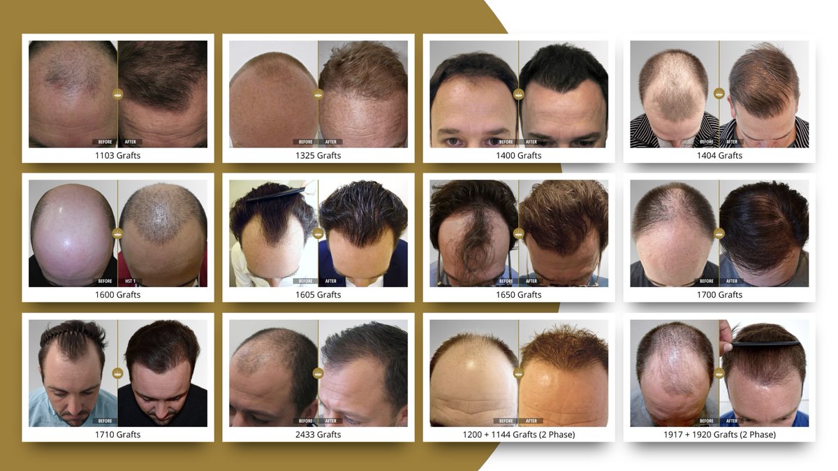 HairScienceHST tweet picture
