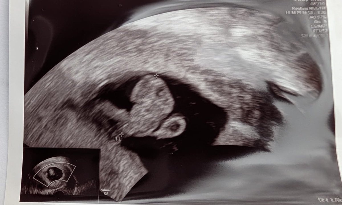 Fabio L. tweet media